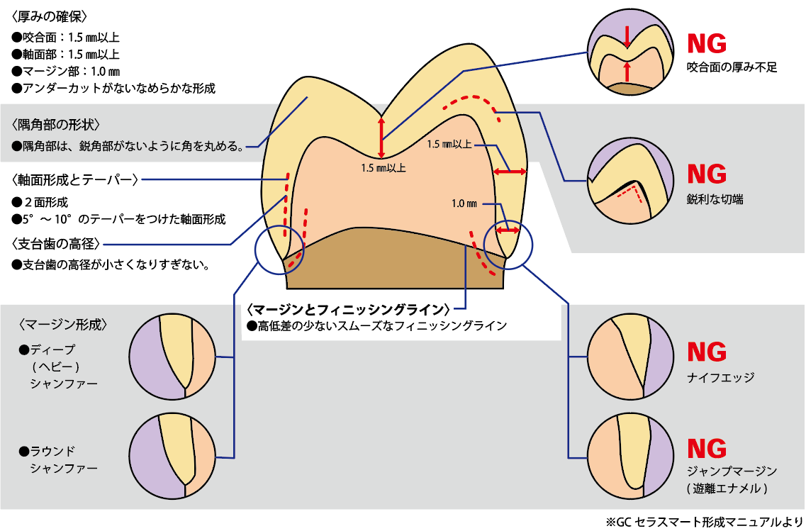 cad cam とは 歯科